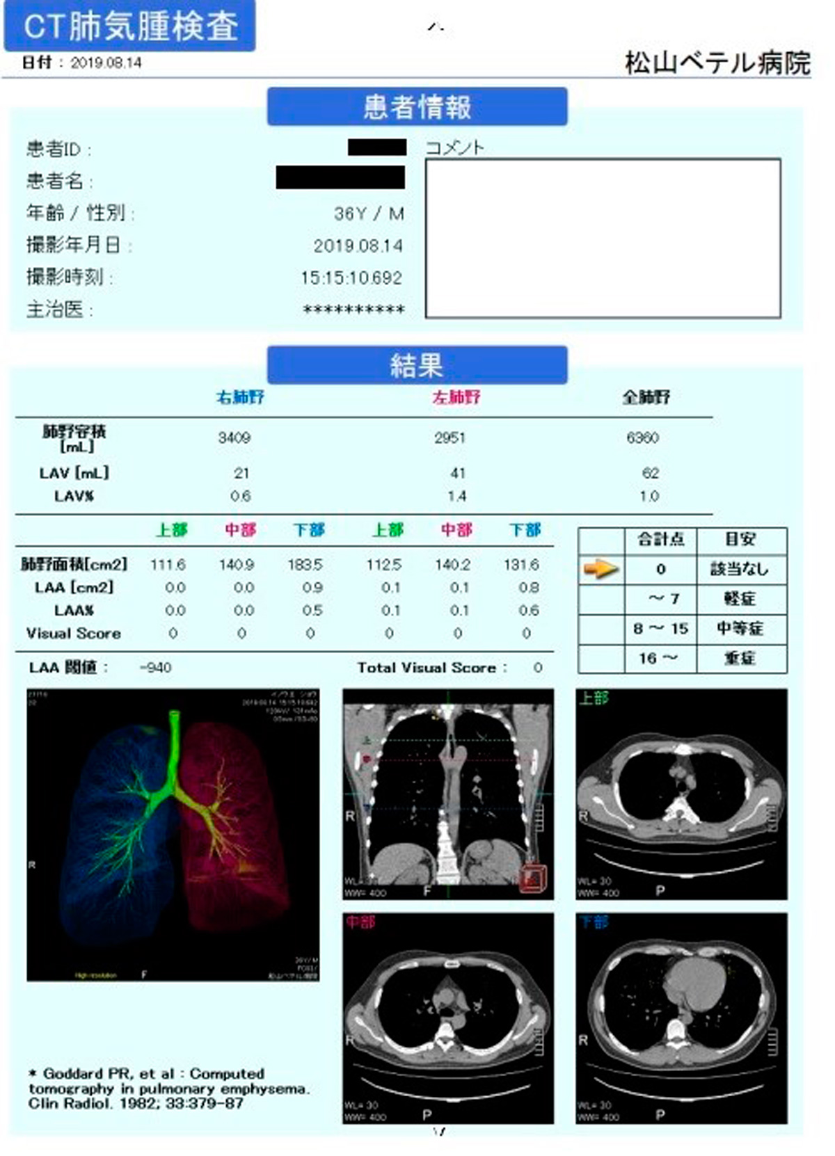 CT肺気腫検査（肺気腫解析）