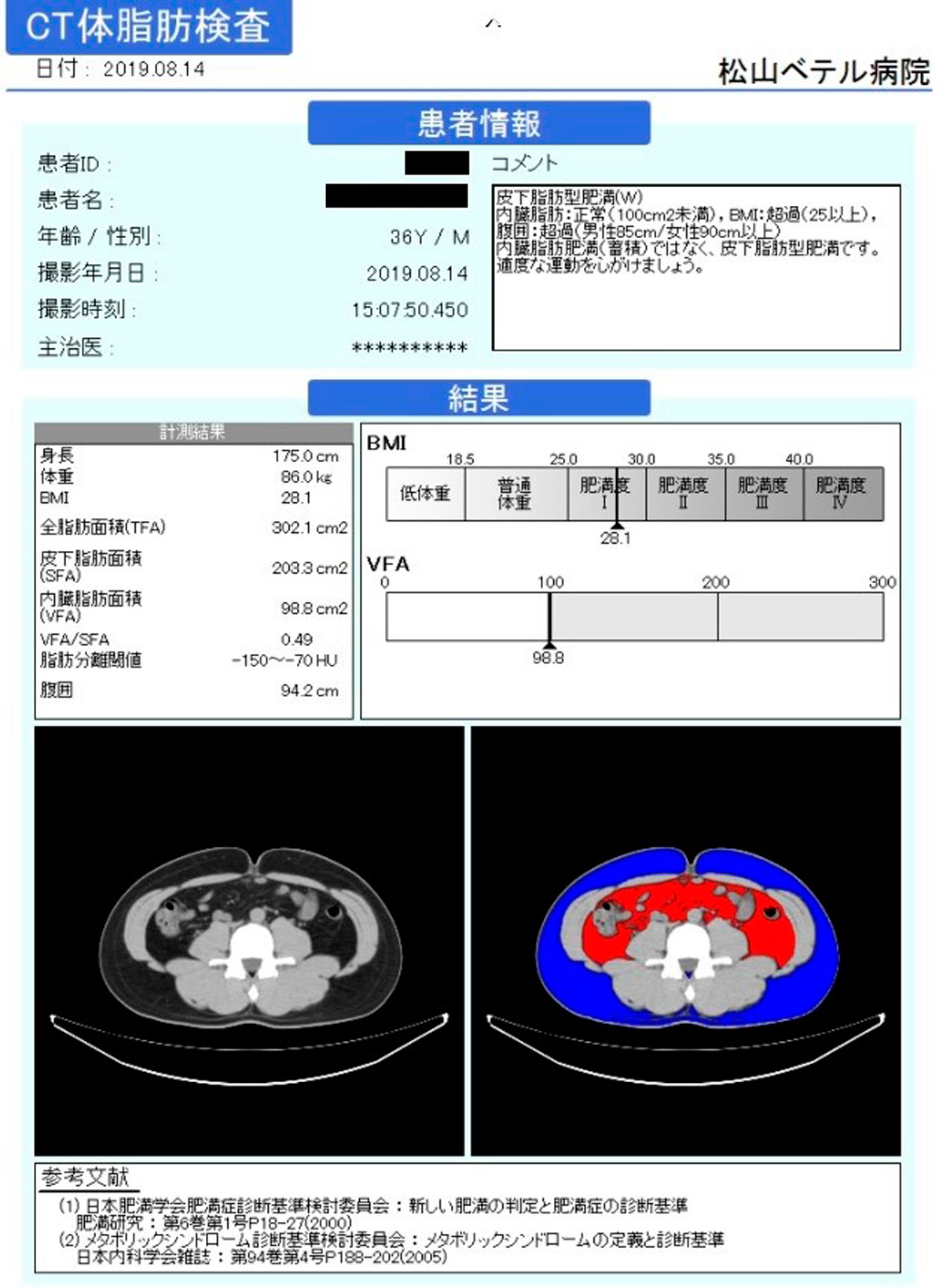 CT体脂肪検査（内臓脂肪解析）